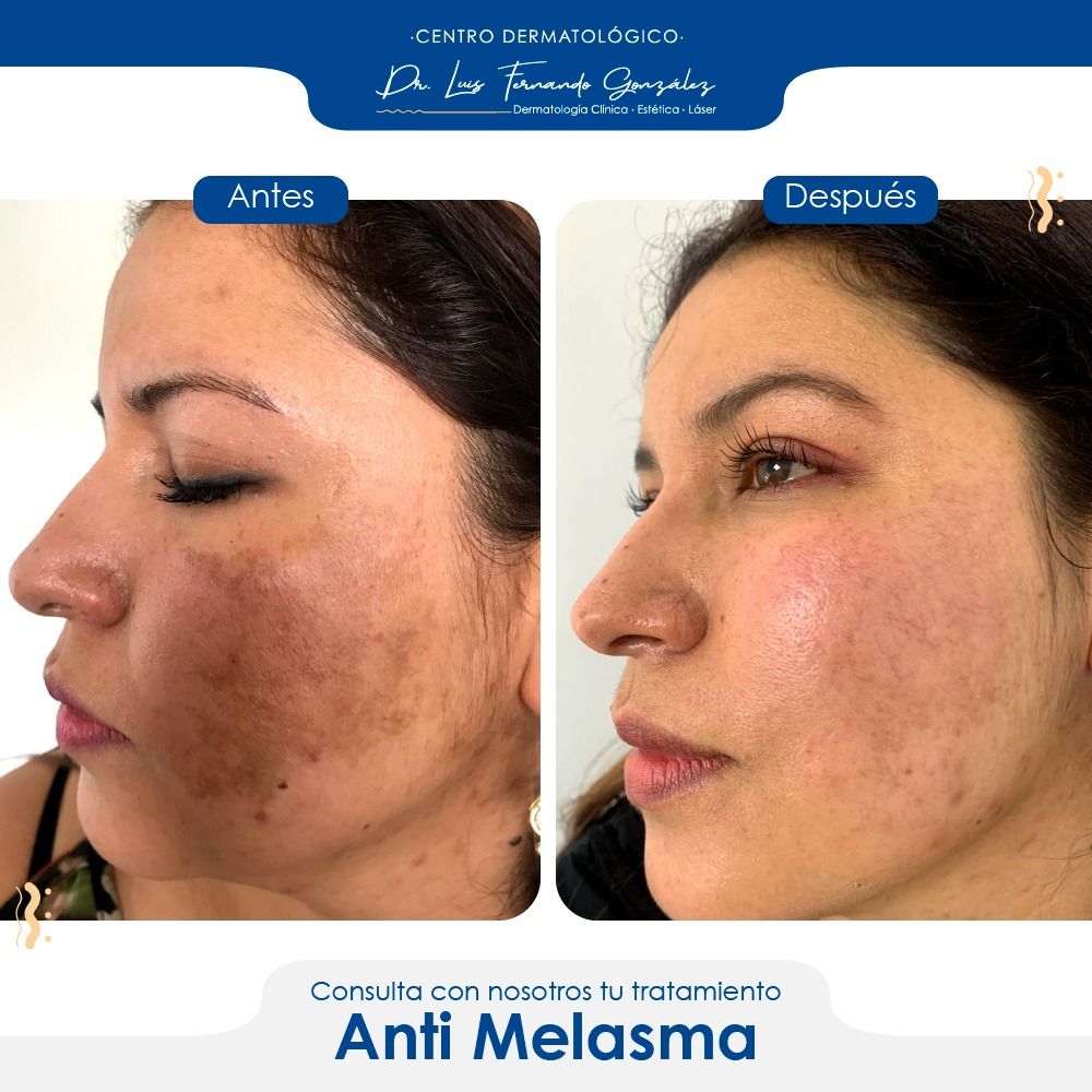 Luis Fernando González-5