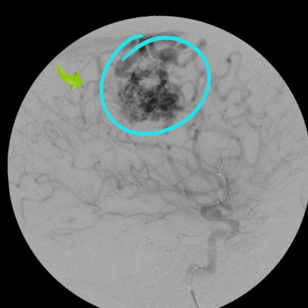 David Tafur Muñoz-1595