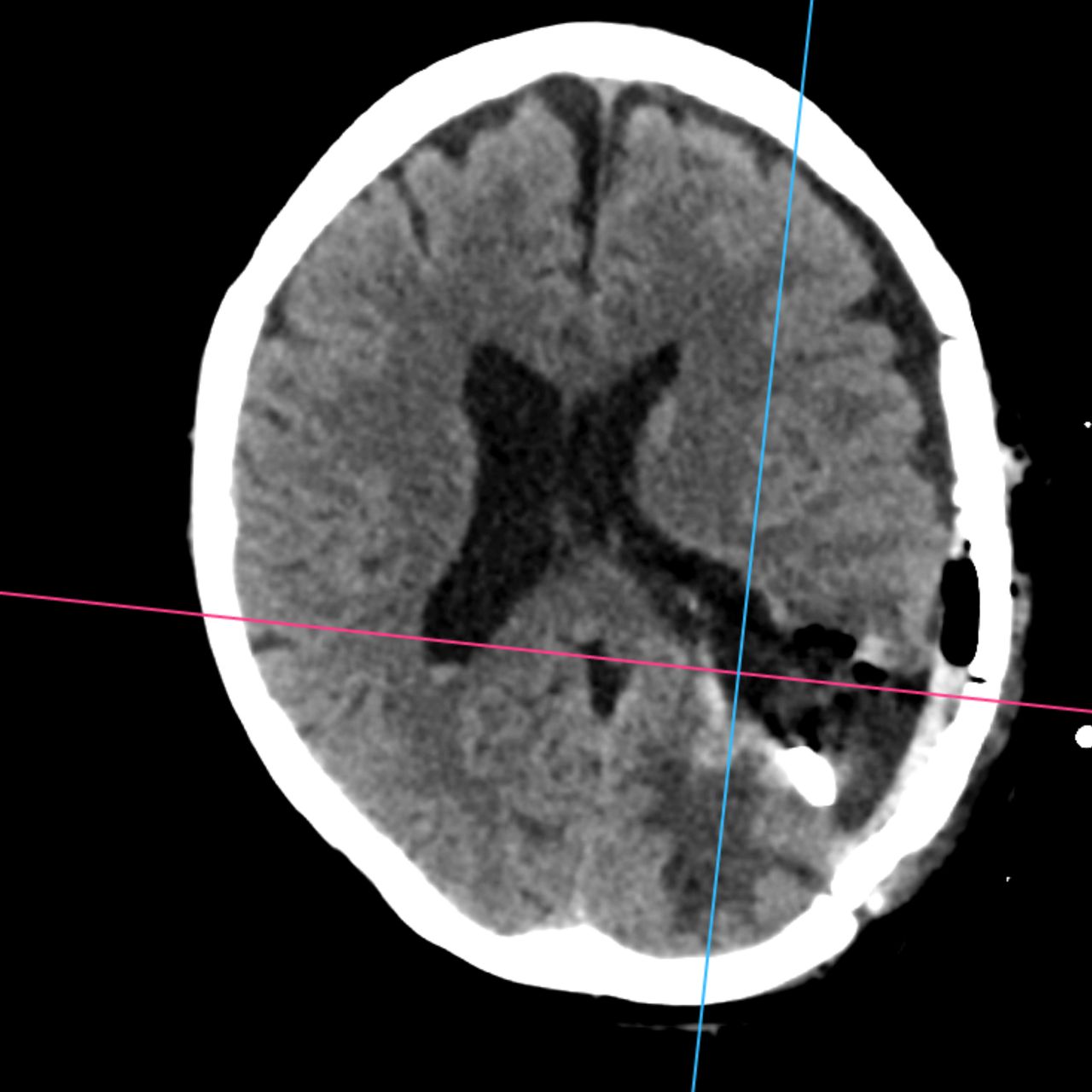 David Tafur Muñoz-2011