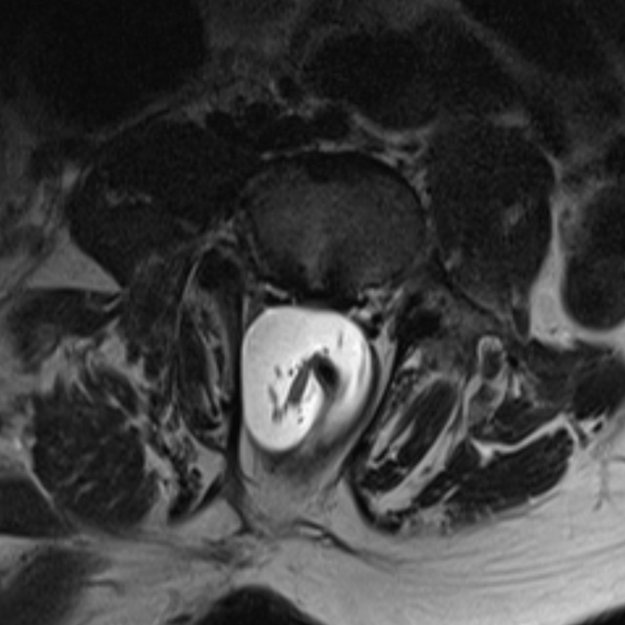 David Tafur Muñoz-1611