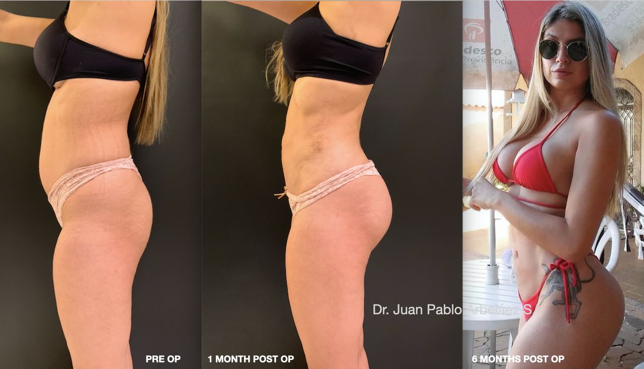 Juan Pablo Arbeláez Sierra-15