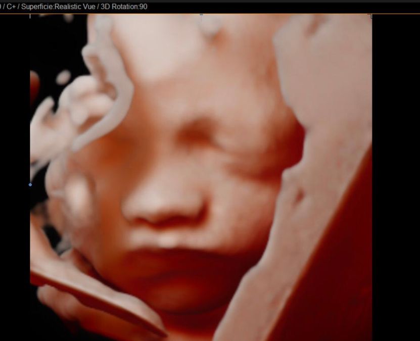 Jonh Harold Alvis Botello-20