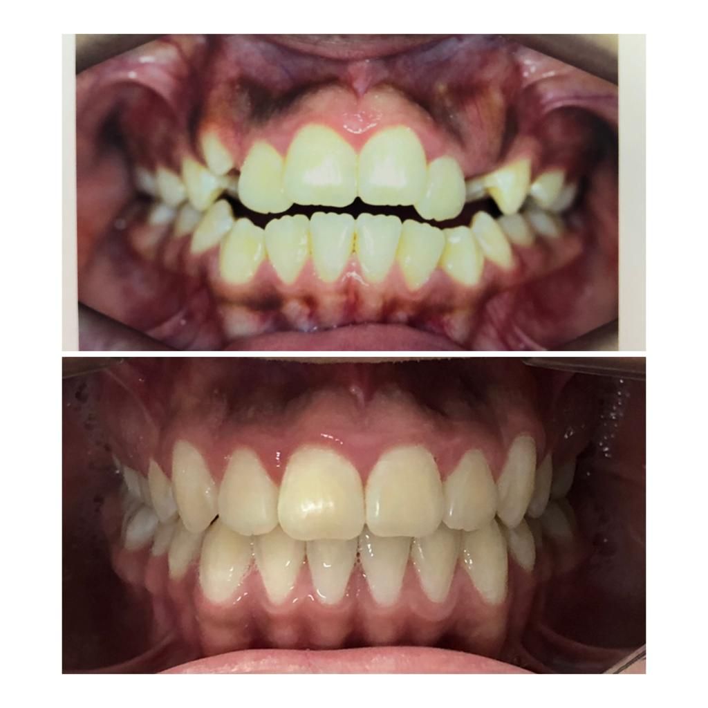 Noara Taline Pereira Dos Reis-4