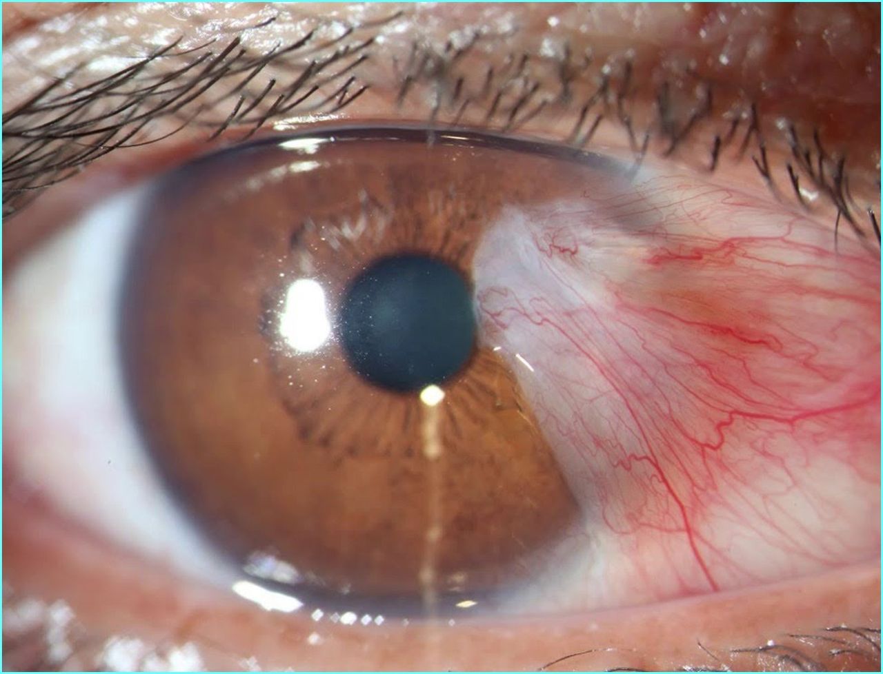 Rafael Lopes De Souza-6