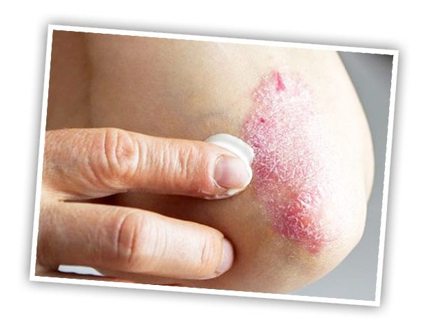 Antonio Carlos Biel-18