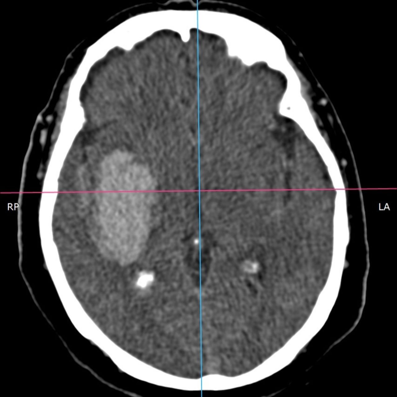 David Tafur Muñoz-1599