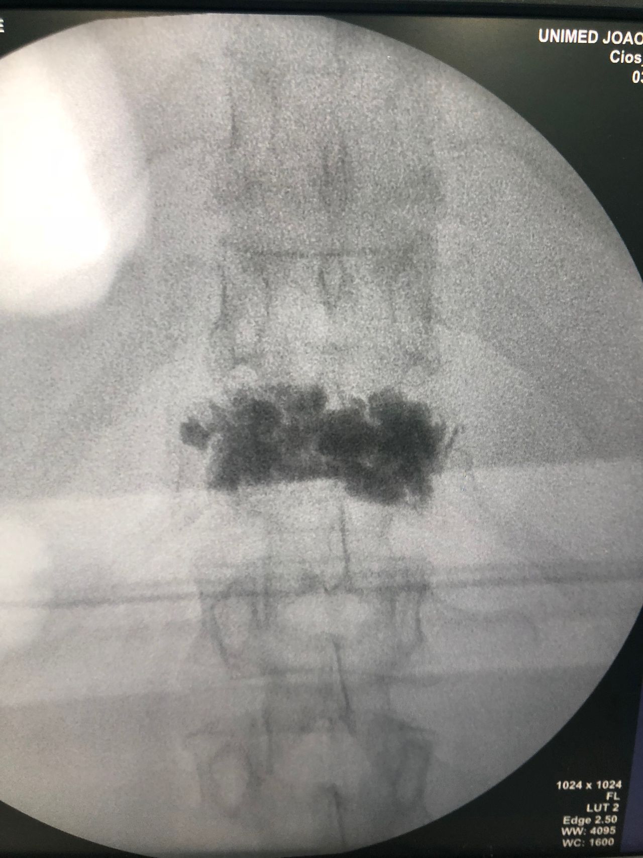 José Lopes Sousa Filho-26