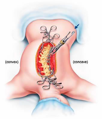 Raphael Teofilo De Souza-2