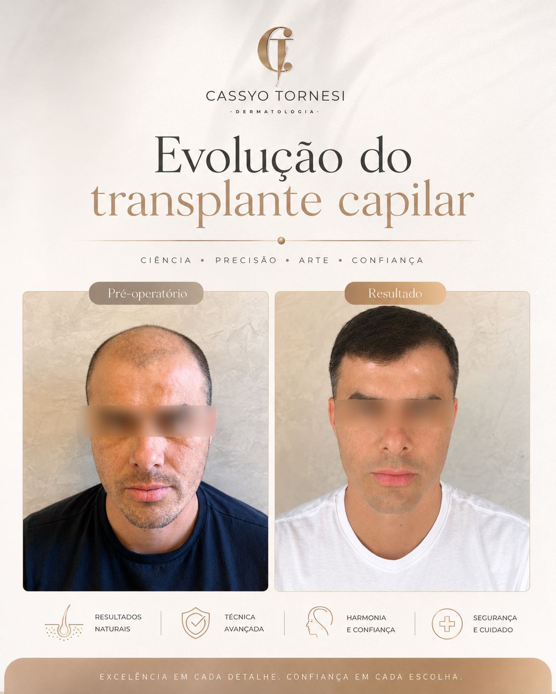 Cassyo Tornesi-13
