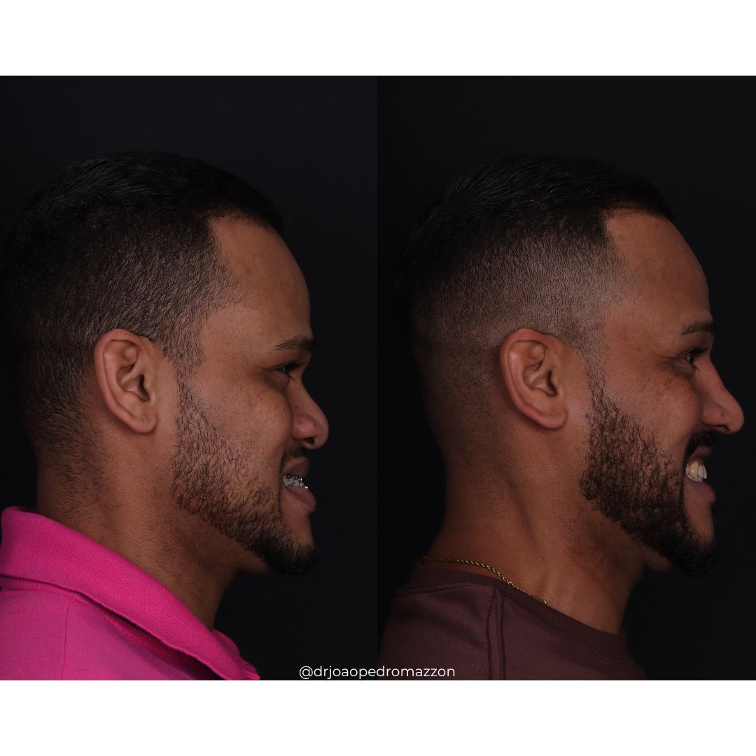 João Pedro Paulino Mazzon-59