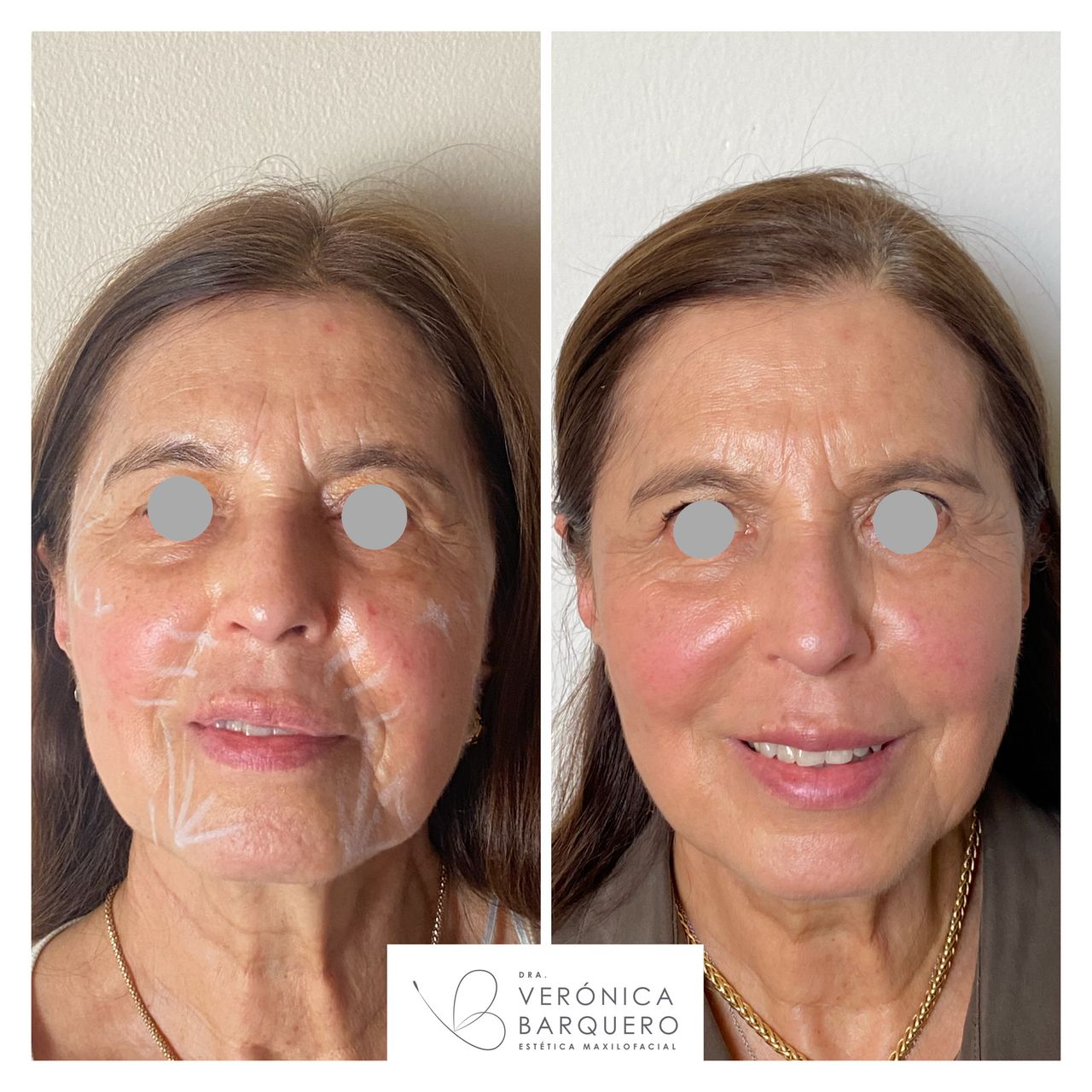 Veronica Maria Barquero Figueroa-21