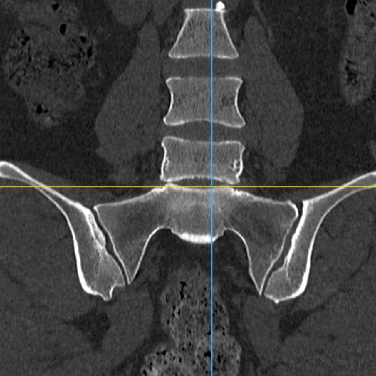David Tafur Muñoz-2455