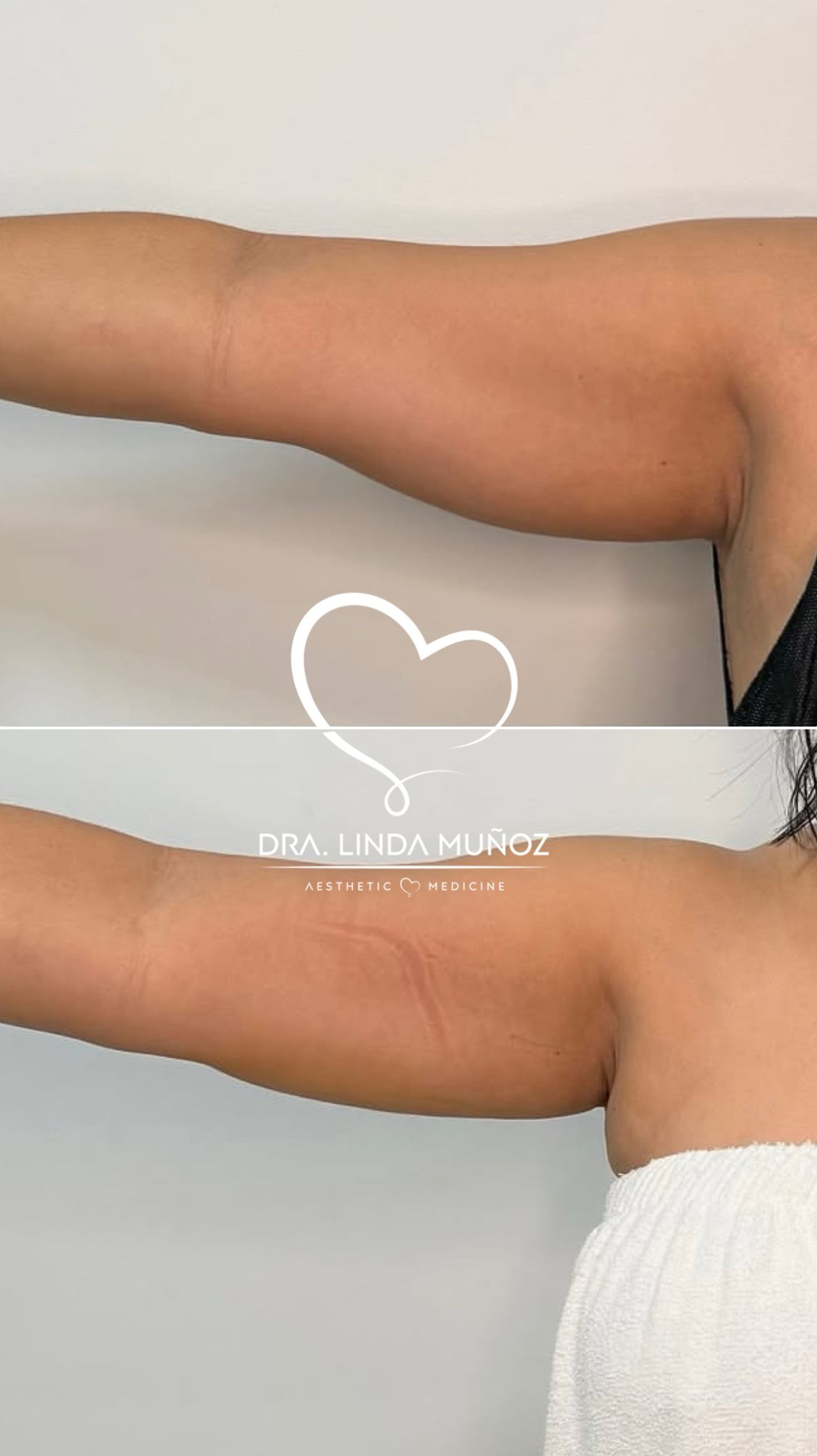 Linda Muñoz-40
