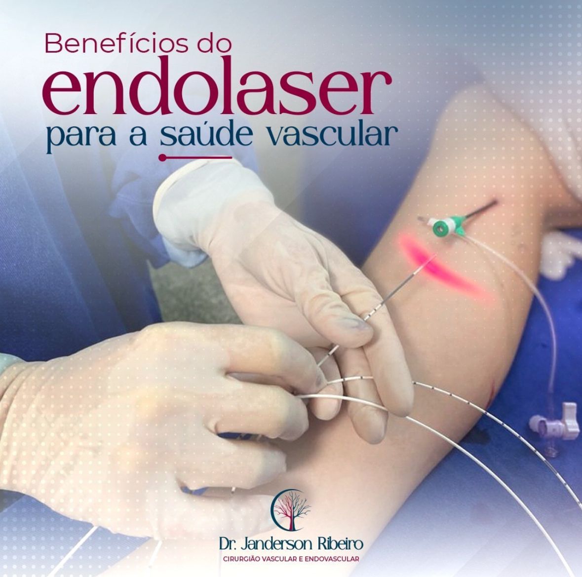 Janderson Ribeiro Fernandes-14