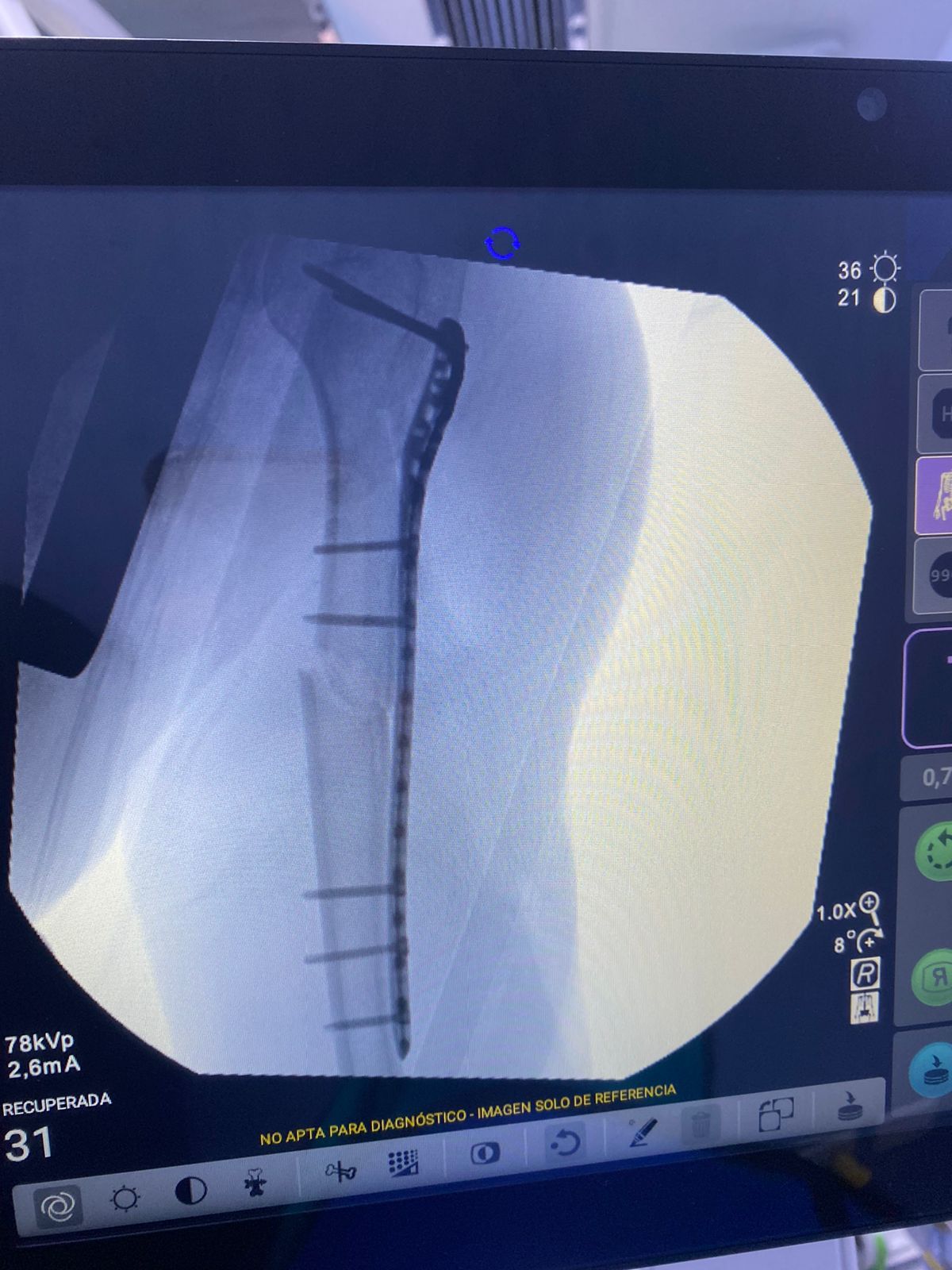 Ramiro Cieza Ojeda-10