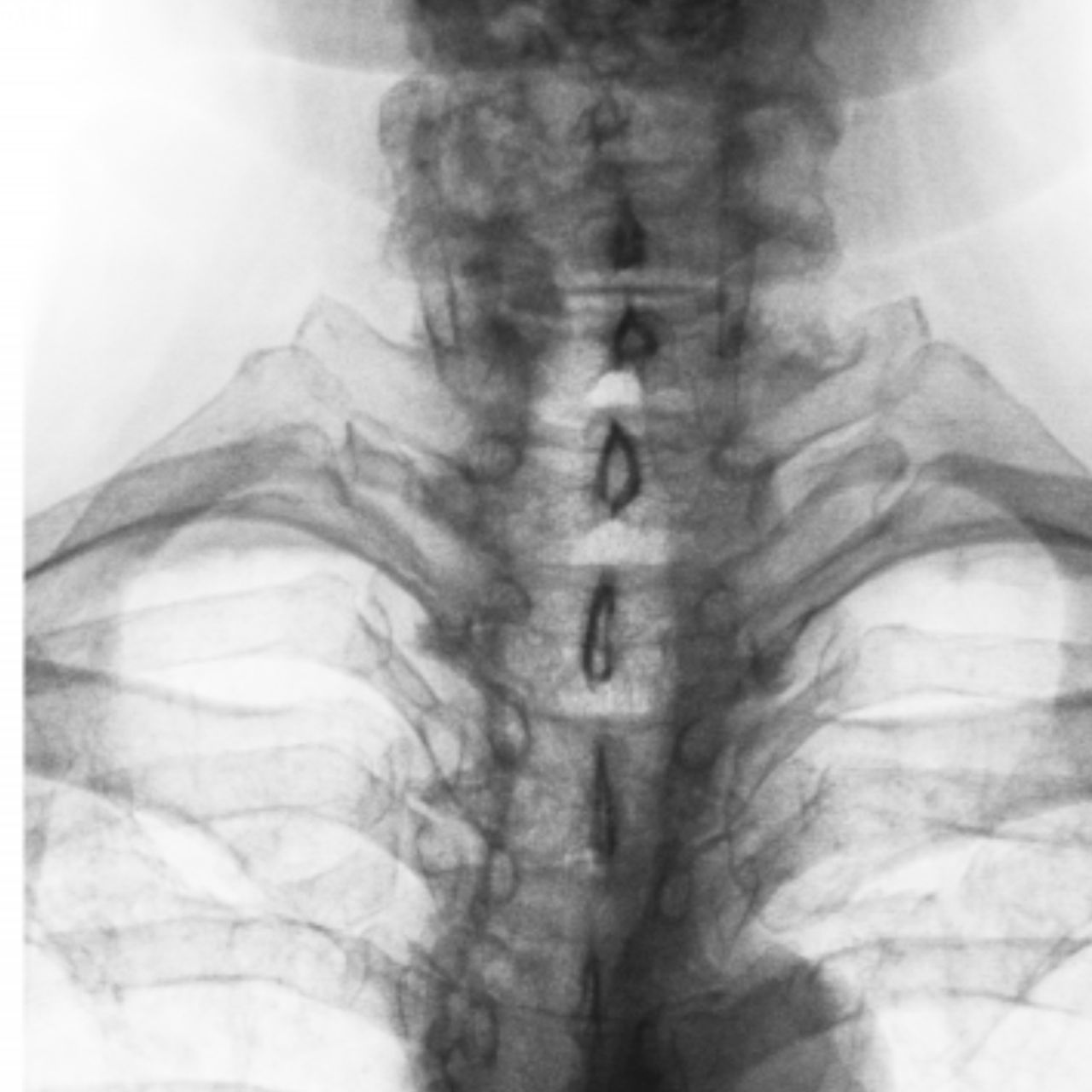 David Tafur Muñoz-1574