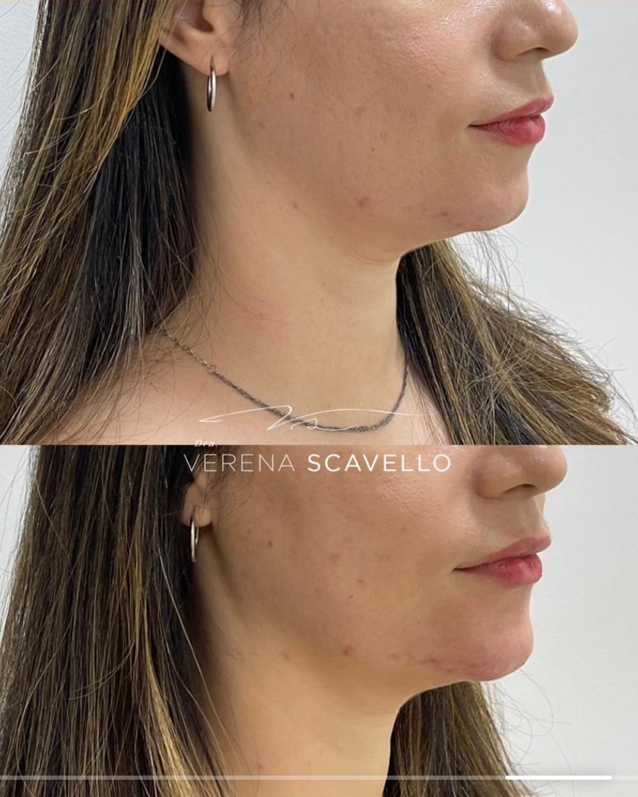 Verena Scavello-15