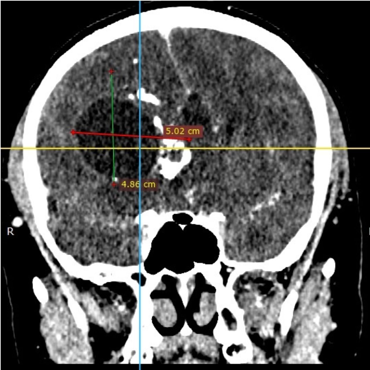 David Tafur Muñoz-1342