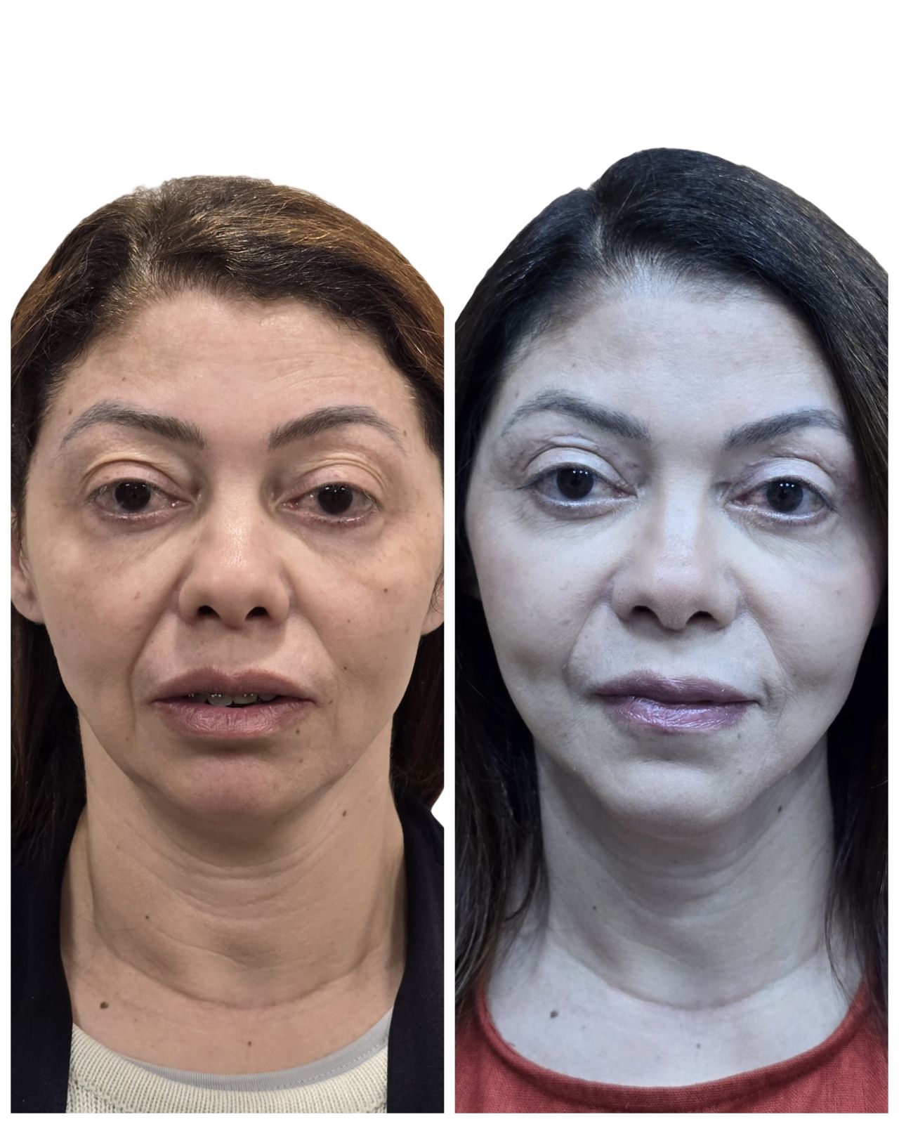 Pedro Henrique Faria Denofrio-11