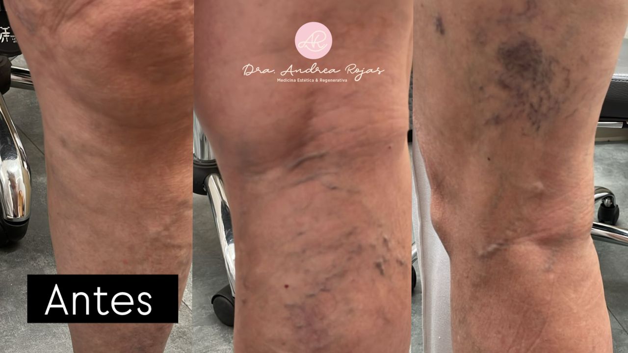 Andrea Rojas Rivera-9