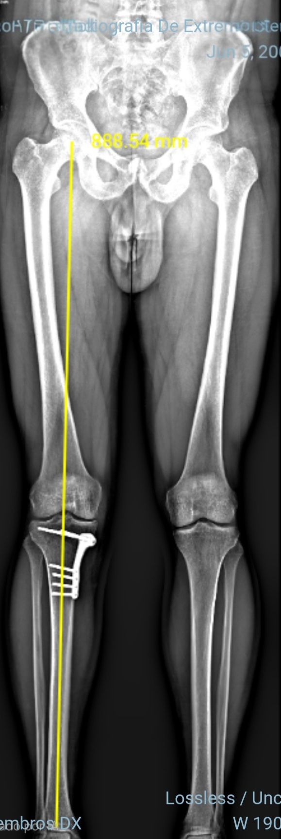 Jose Antonio Cordero Zirotti-7