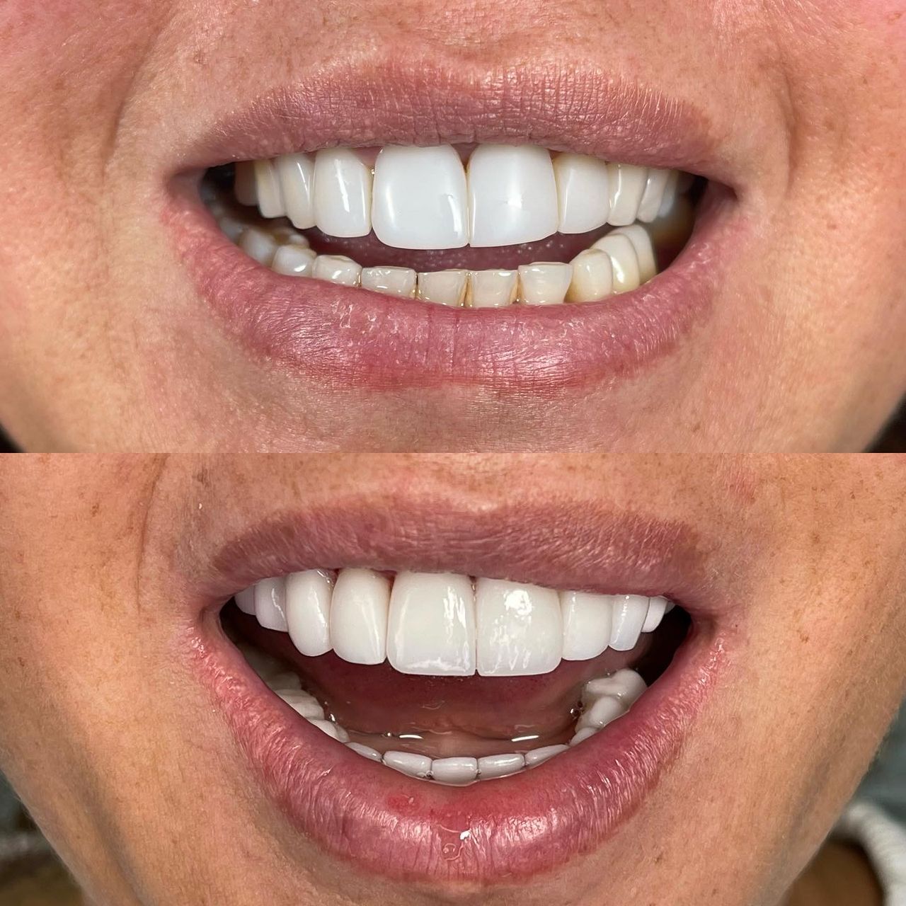 Franci Yulied López Jiménez-9