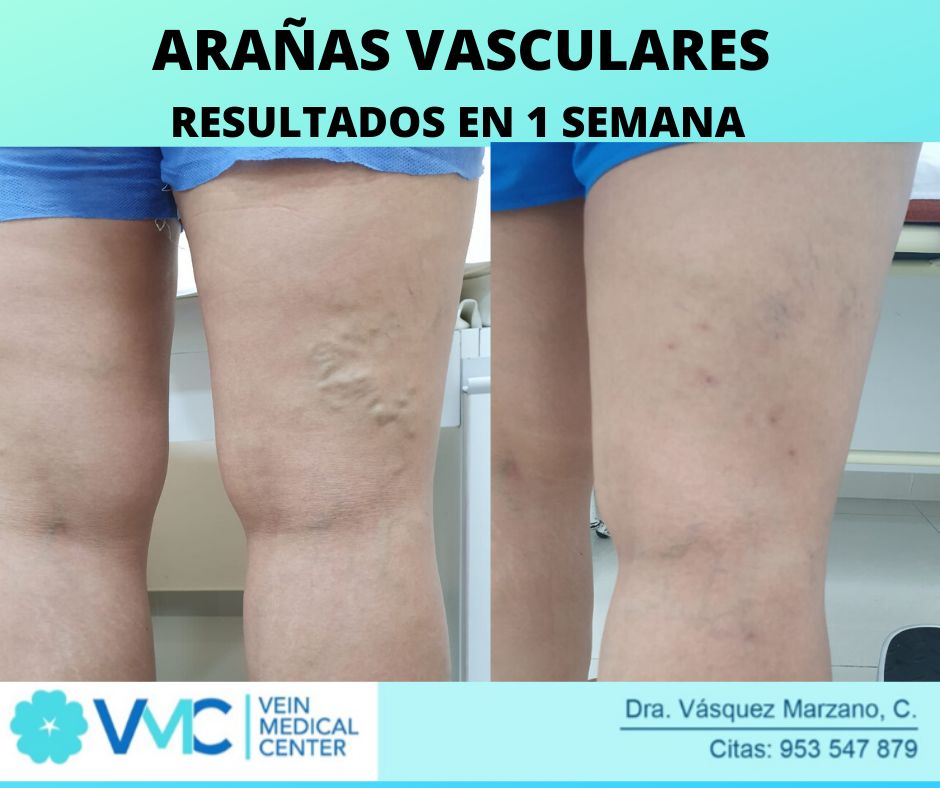 Cindy Vásquez Marzano-11