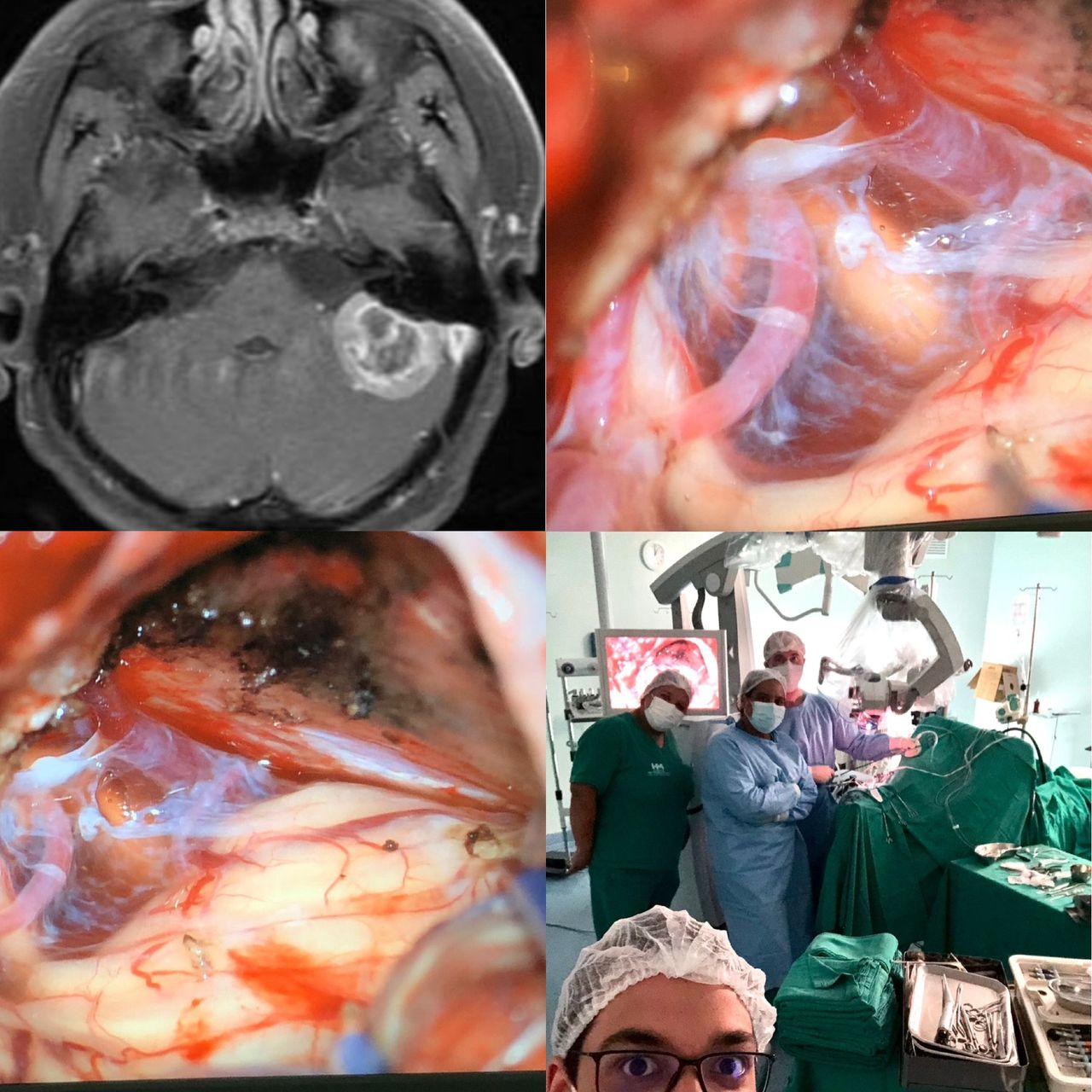 José Lopes Sousa Filho-3