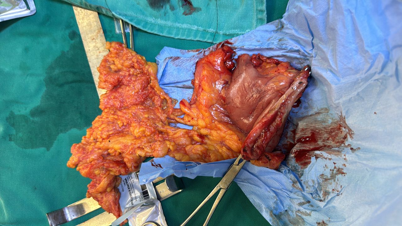 Alexander Alonso Lázaro Chumbe-20