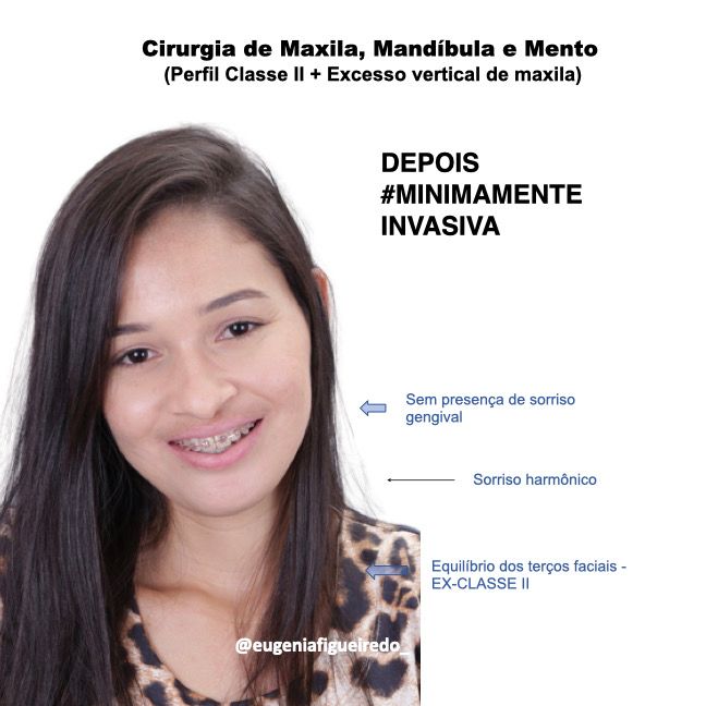 Eugênia Figueiredo-36