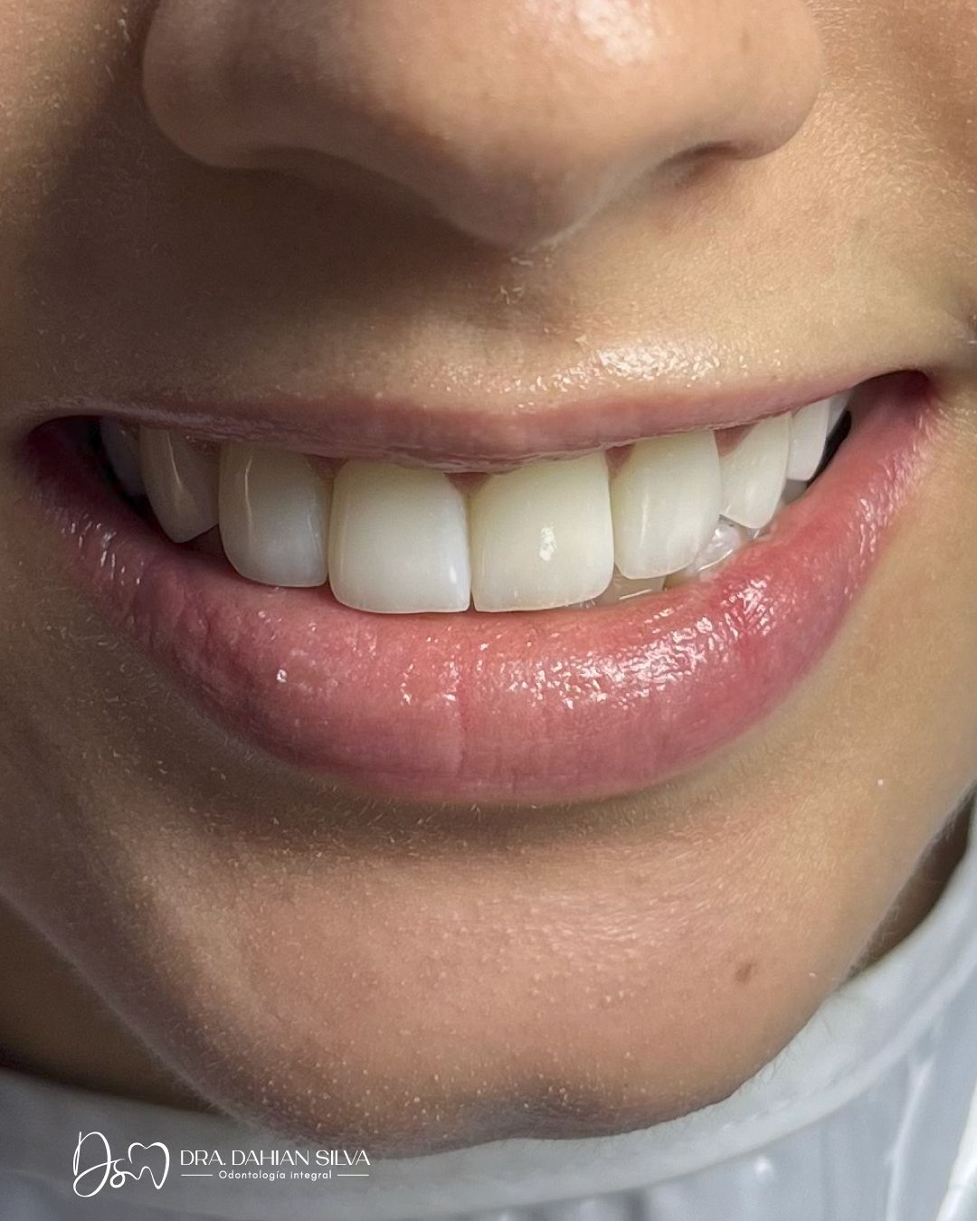 Dahian Lized Silva Polania-3