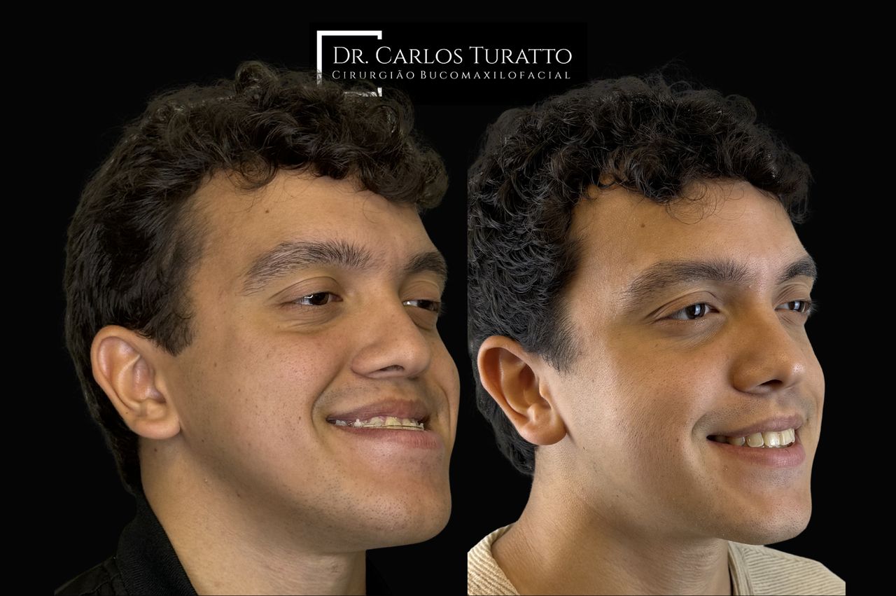 Carlos Turatto-6