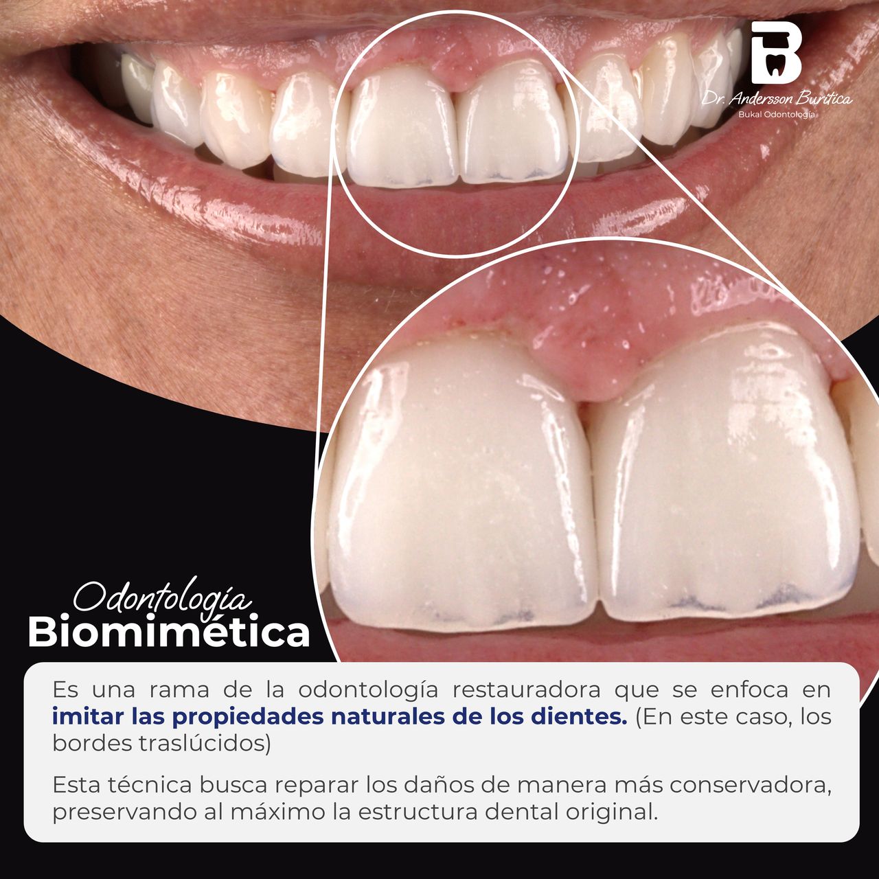 Andersson Buritica-5
