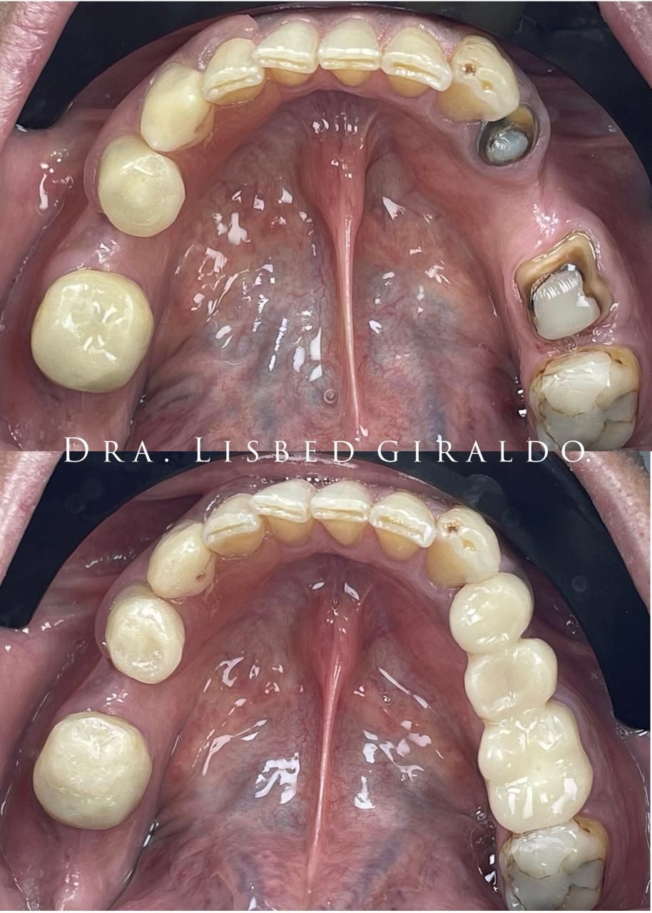 Lisbed Giraldo Olarte-27