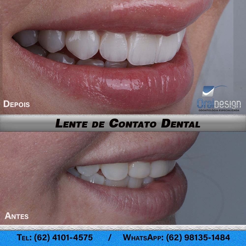 Danilo Monteiro Rezende Pereira-11