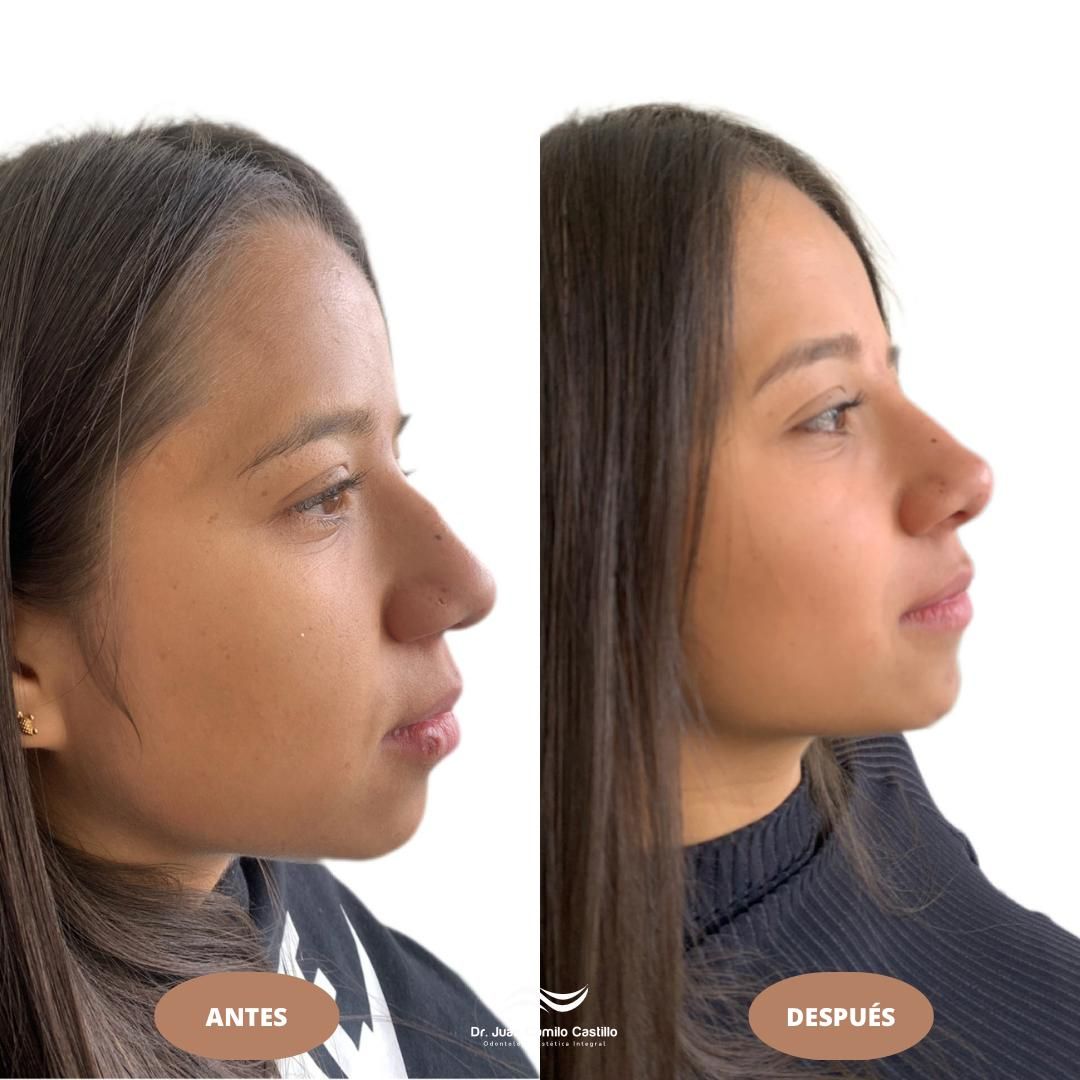 Juan Camilo Castillo-20