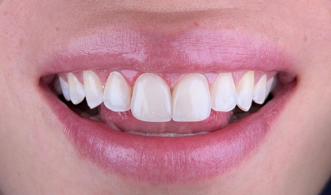 Melissa Vargas Castellanos-23