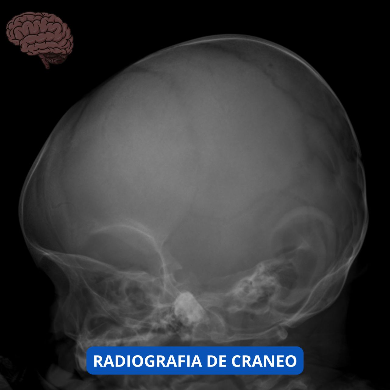 David Tafur Muñoz-1963