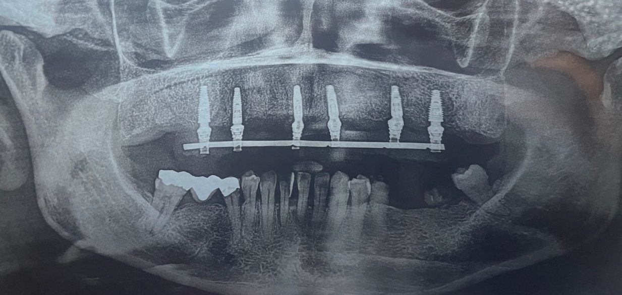 Natalia Grajales Fernández-2