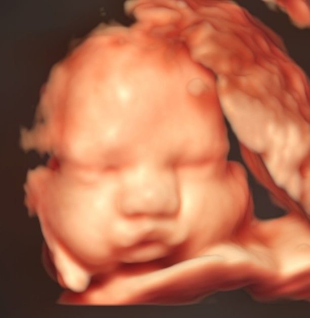 Charles Schwantz De Lima-8