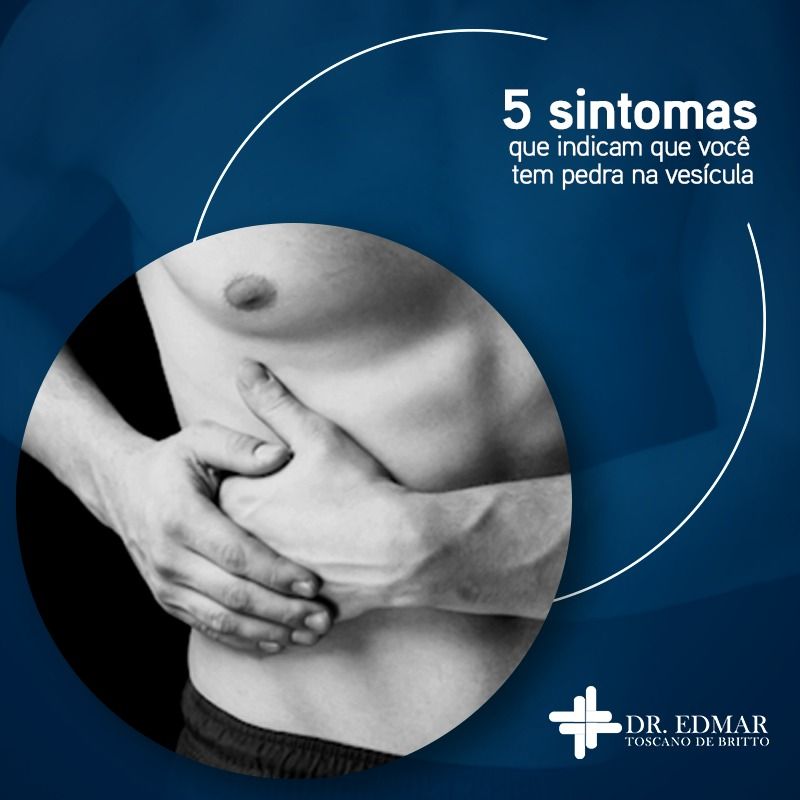 Edmar Toscano De Britto-11