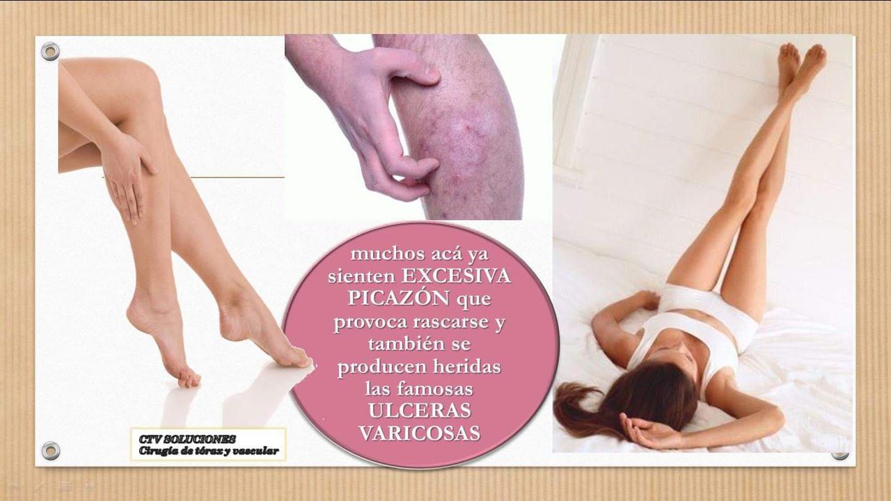 Walter Rodolfo Calle Mendoza-6