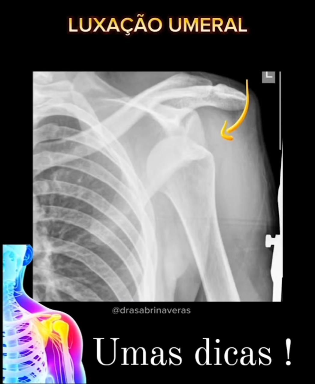 Orlando Turpo Mamani-1