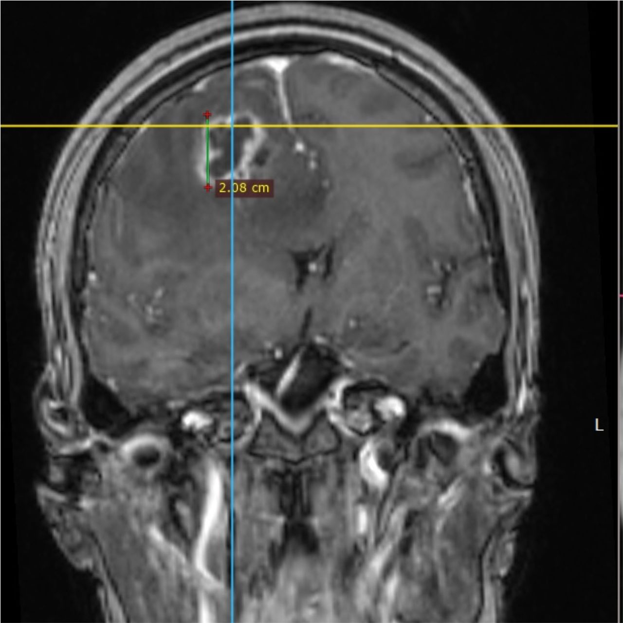 David Tafur Muñoz-1475