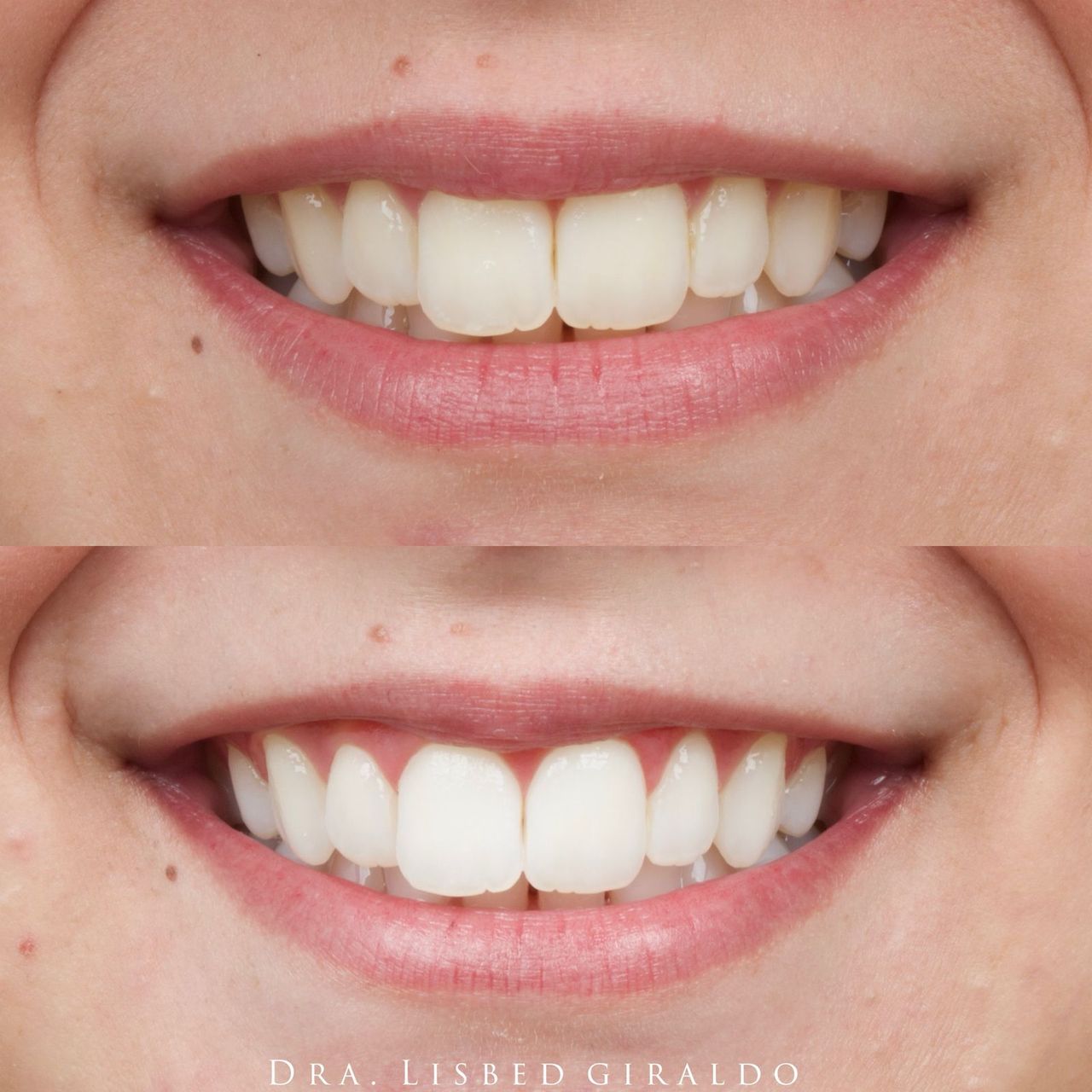 Lisbed Giraldo Olarte-7