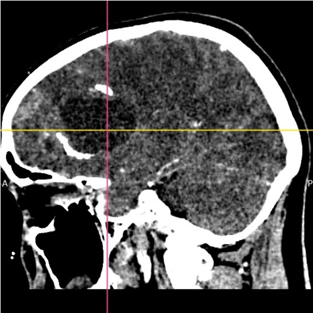 David Tafur Muñoz-1382