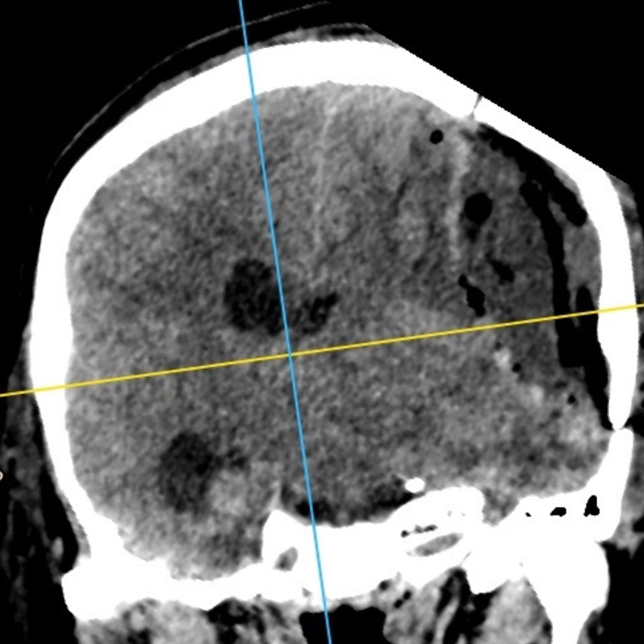 David Tafur Muñoz-1391