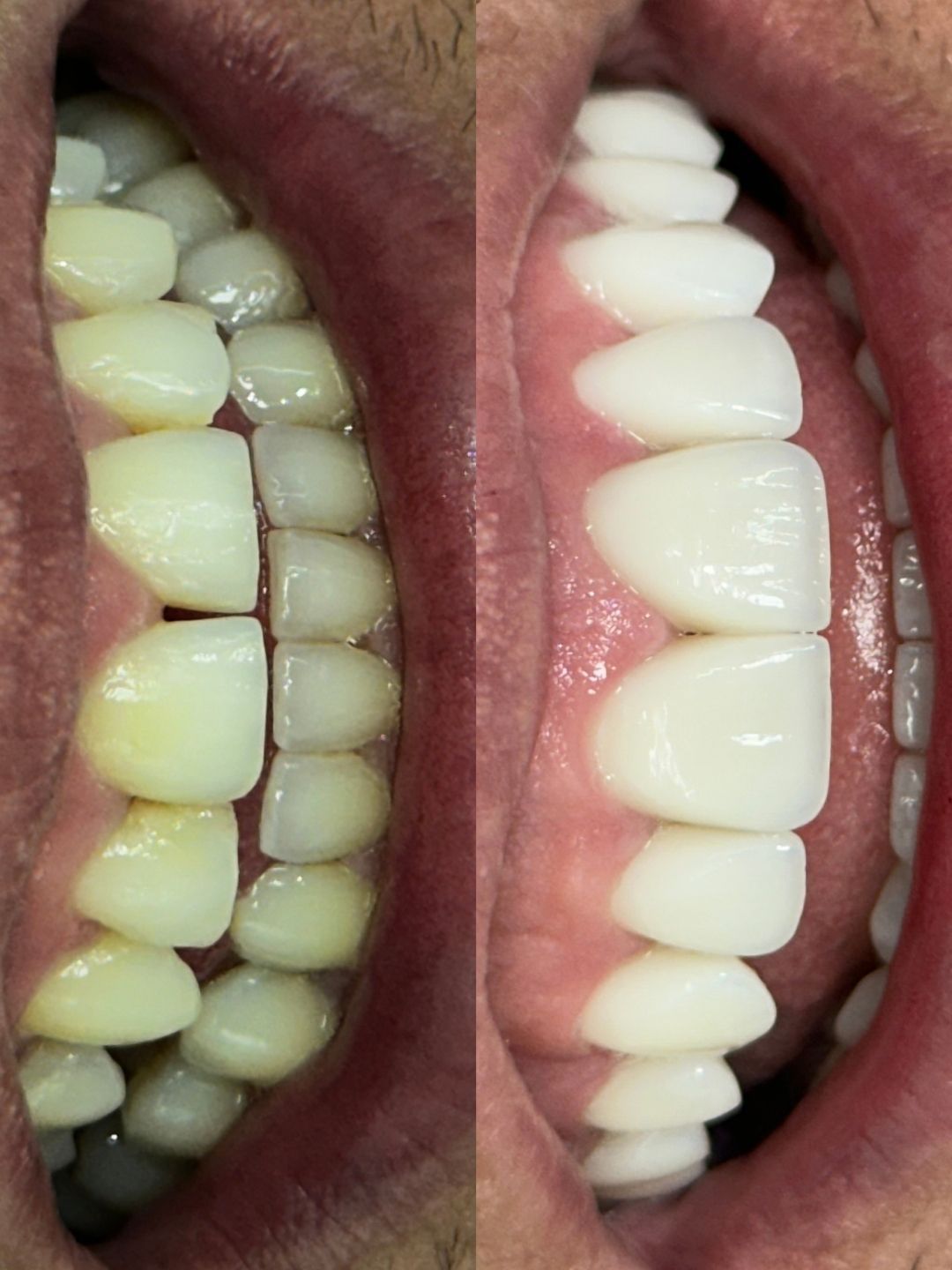 Valentina Hernández Cardenas-2