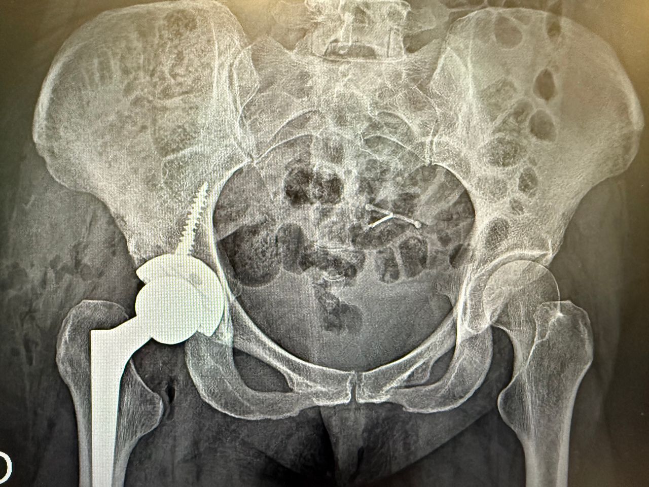 Rodrigo Muñoz Sabugo-1