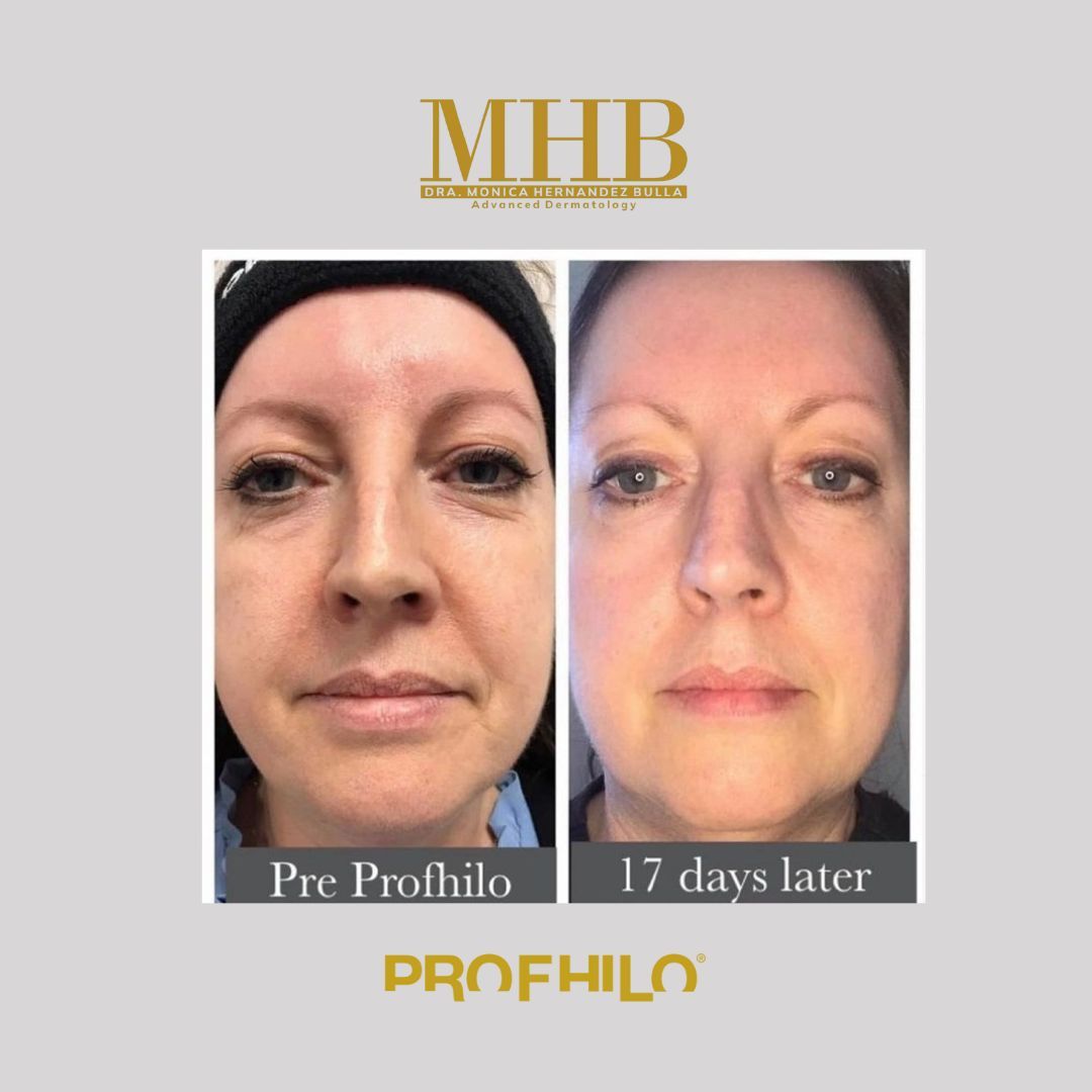 Mónica Hernandez Bulla-29